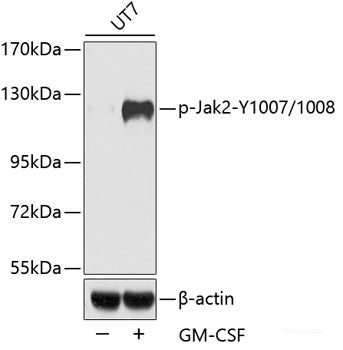 Immunohistochemistry analysis of paraffin-embedded mouse spinal marrow  using NOS2 Polyclonal Antibody at dilution of 1:500.