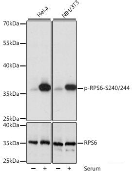 Immunohistochemistry analysis of paraffin-embedded mouse spinal marrow  using NTRK2 Polyclonal Antibody at dilution of 1:400.