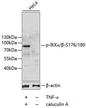 Immunohistochemistry analysis of paraffin-embedded mouse colon  using PPARA Polyclonal Antibody at dilution of 1:300.