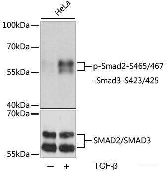 Immunohistochemistry analysis of paraffin-embedded mouse spleen  using ATG7 Polyclonal Antibody at dilution of 1:300.
