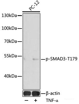 Immunohistochemistry analysis of paraffin-embedded Mouse brain  using AQP4 Polyclonal Antibody at dilution of 1:400.