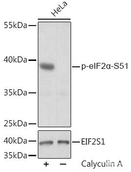 Immunohistochemistry analysis of paraffin-embedded mouse spleen  using HMOX1 Polyclonal Antibody at dilution of 1:500.