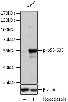 Immunohistochemistry analysis of paraffin-embedded human tonsil  using SIRT1 Polyclonal Antibody at dilution of 1:500.