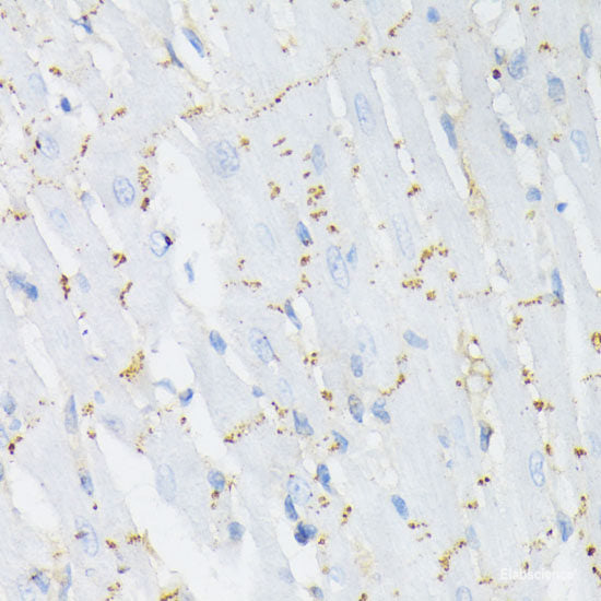 Immunohistochemistry analysis of paraffin-embedded mouse spleen  using CCR5 Polyclonal Antibody at dilution of 1:300.