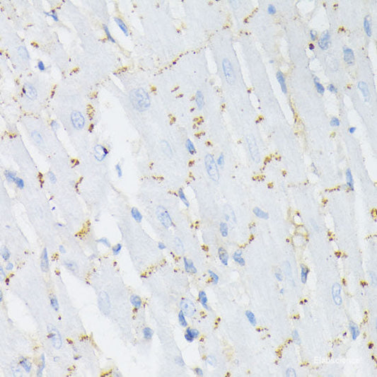Immunohistochemistry analysis of paraffin-embedded mouse spleen  using CCR5 Polyclonal Antibody at dilution of 1:300.