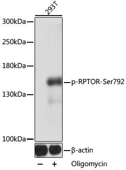 Immunohistochemistry analysis of paraffin-embedded Human tonsil  using CD19 Polyclonal Antibody at dilution of 1:300.