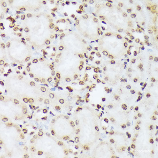 Immunohistochemistry analysis of paraffin-embedded mouse brain  using S100B Polyclonal Antibody at dilution of 1:400.