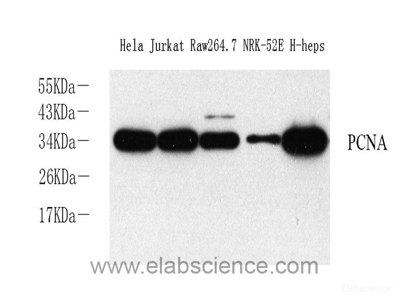 Immunohistochemistry analysis of paraffin-embedded mouse brain  using GDNF Polyclonal Antibody at dilution of 1:300.