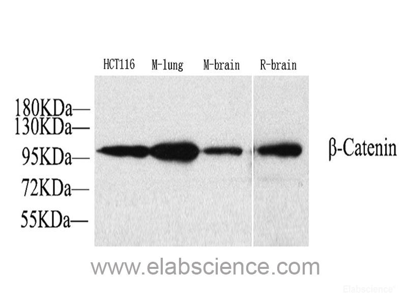 Immunohistochemistry analysis of paraffin-embedded human brain  using GLUT-1 Polyclonal Antibody at dilution of 1:300.