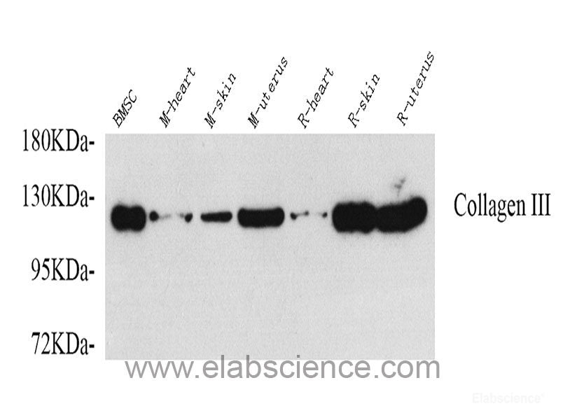 Immunohistochemistry analysis of paraffin-embedded mouse heart  using TNNT2 Polyclonal Antibody at dilution of 1:200.
