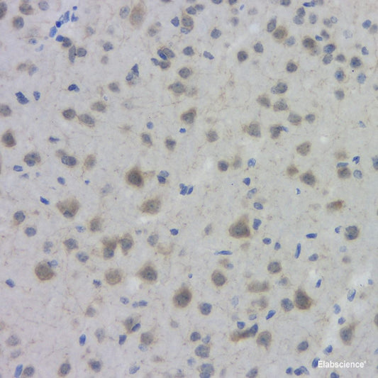 Immunohistochemistry analysis of paraffin-embedded A549 in Human breast  using CASP3 Polyclonal Antibody at dilution of 1:400.