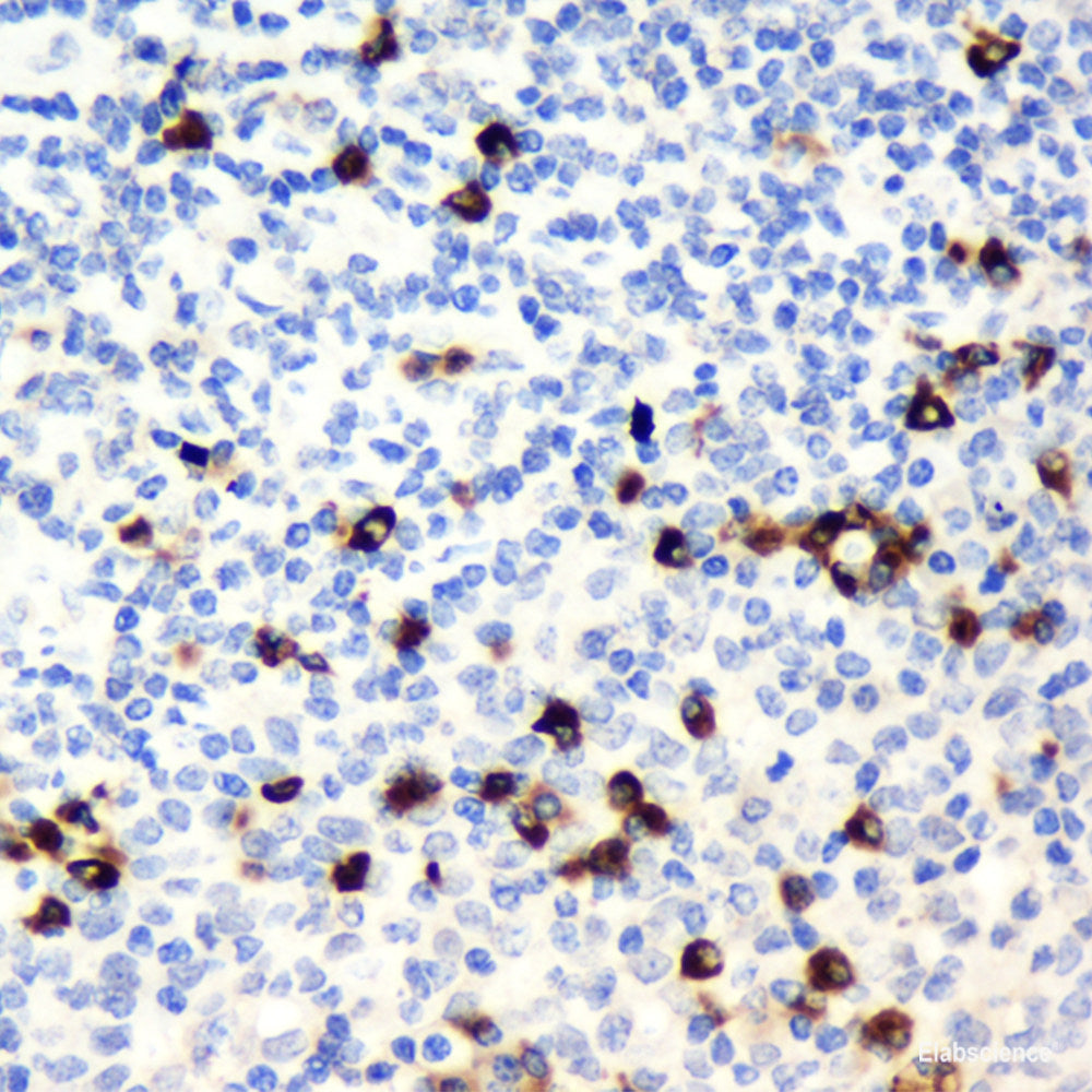 Immunohistochemistry analysis of paraffin-embedded human colon  using CCL2 Polyclonal Antibody at dilution of 1:500.