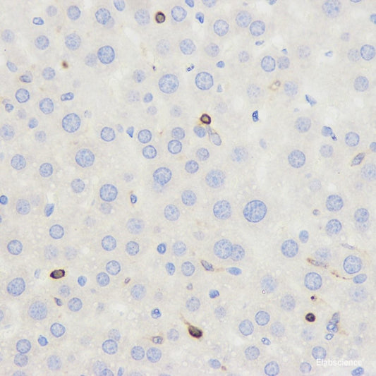 Immunohistochemistry analysis of paraffin-embedded human stomach  using PTEN Polyclonal Antibody at dilution of 1:200.