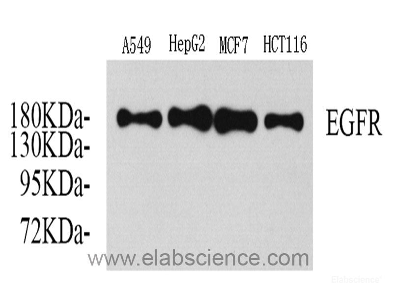 Immunohistochemistry analysis of paraffin-embedded mouse spleen  using CD177 Polyclonal Antibody at dilution of 1:300.