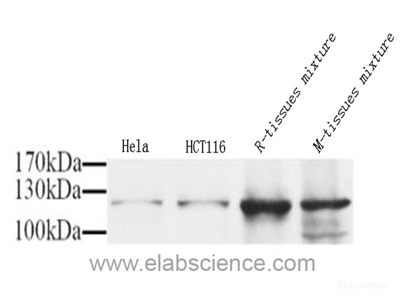Immunohistochemistry analysis of paraffin-embedded human lung cancer  using CD107b Polyclonal Antibody at dilution of 1:300.