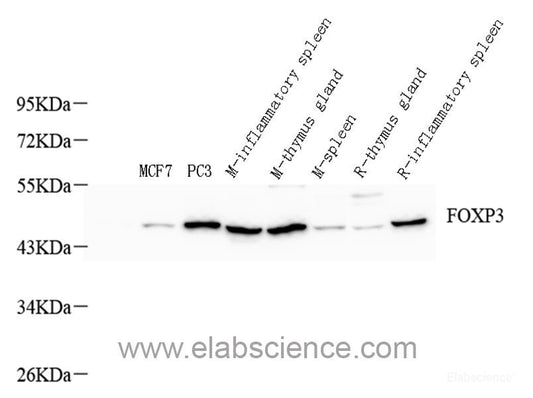 Immunohistochemistry analysis of paraffin-embedded human colon  using IL22RA1 Polyclonal Antibody at dilution of 1:200.