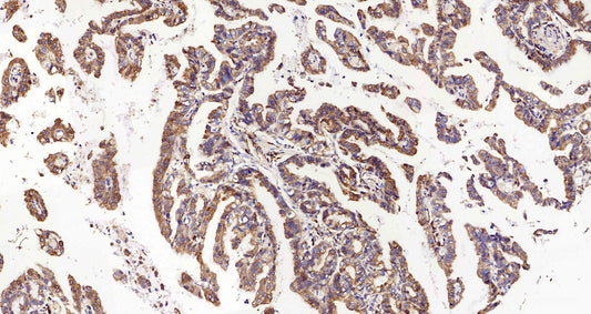 Immunohistochemistry analysis of paraffin-embedded mouse inflammation spleen  using INPP5D Polyclonal Antibody at dilution of 1:300.