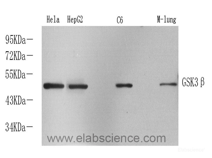 Immunohistochemistry analysis of paraffin-embedded human kidney  using CTGF Polyclonal Antibody at dilution of 1:100.