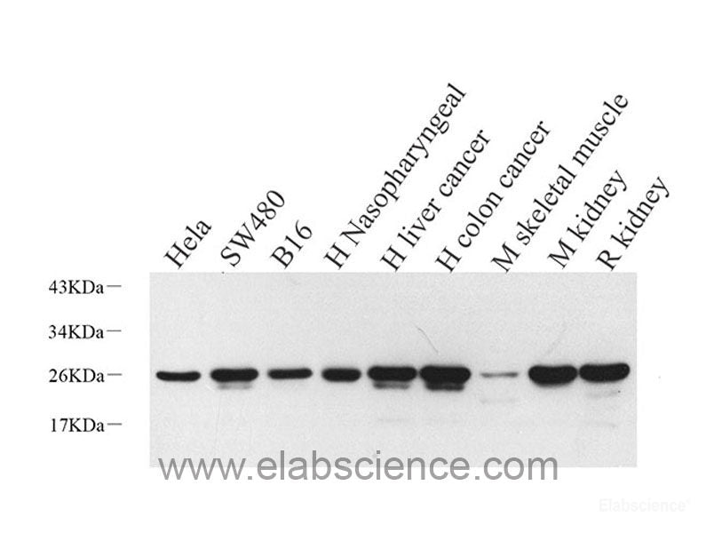 Immunohistochemistry analysis of paraffin-embedded mouse liver  using CK-7 Polyclonal Antibody at dilution of 1:300.