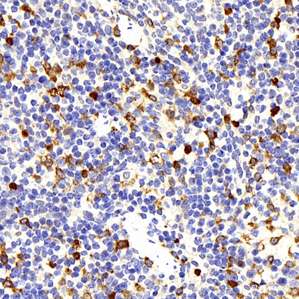 Immunohistochemistry analysis of paraffin-embedded human gallbladder   using FAS Monoclonal Antibody at dilution of 1:200.
