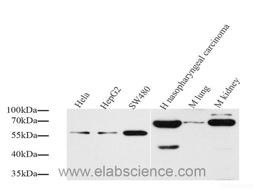 Immunohistochemistry analysis of parafffin-embedded mouse spleen  using P2RX3 Polyclonal Antibody at dilution of 1:400.