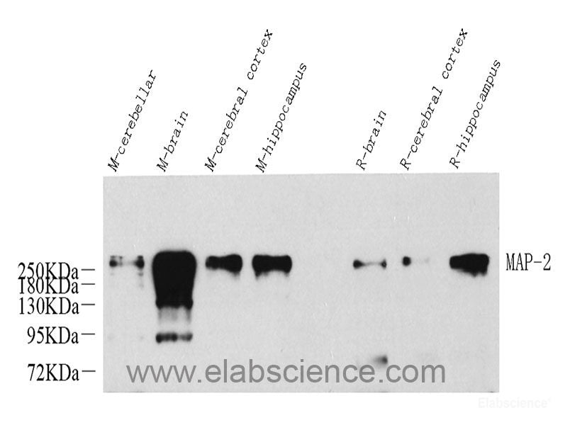 Immunohistochemistry analysis of paraffin-embedded mouse lung  using TSC22D3 Polyclonal Antibody at dilution of 1:300.