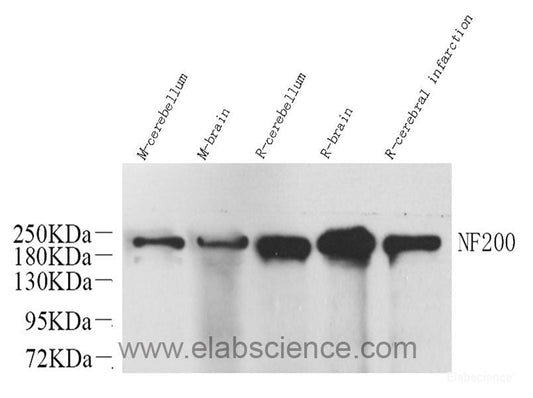 Immunohistochemistry analysis of paraffin-embedded human tonsil  using c-Kit Polyclonal Antibody at dilution of 1:200.