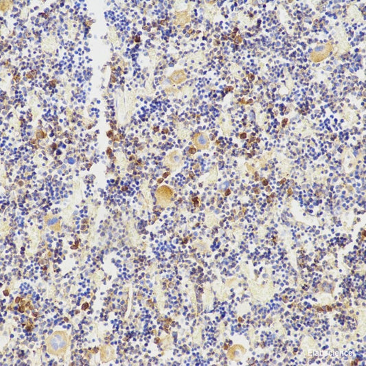 Immunohistochemistry analysis of paraffin-embedded mouse testis  using SNAI1 Polyclonal Antibody at dilution of 1:600.