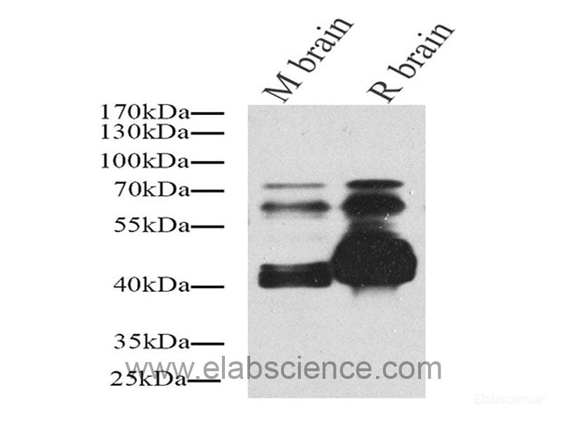 Immunohistochemistry analysis of paraffin-embedded mouse Inflammatory lung  using Ly6g Polyclonal Antibody at dilution of 1:200.