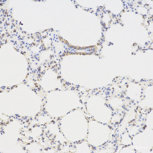 Immunohistochemistry analysis of paraffin-embedded mouse brain  using CHAT Polyclonal Antibody at dilution of 1:300.