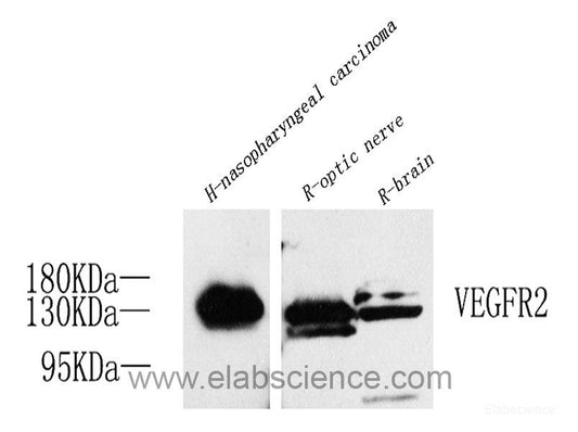 Western Blot analysis of various samples using ACE2 Polyclonal Antibody at dilution of 1:1000.