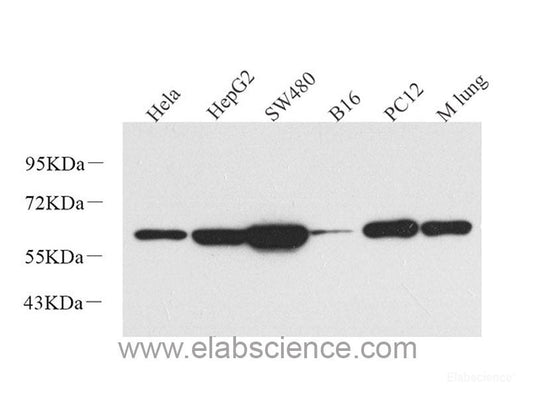 Western Blot analysis of various samples using p63 Polyclonal Antibody at dilution of 1:1000.