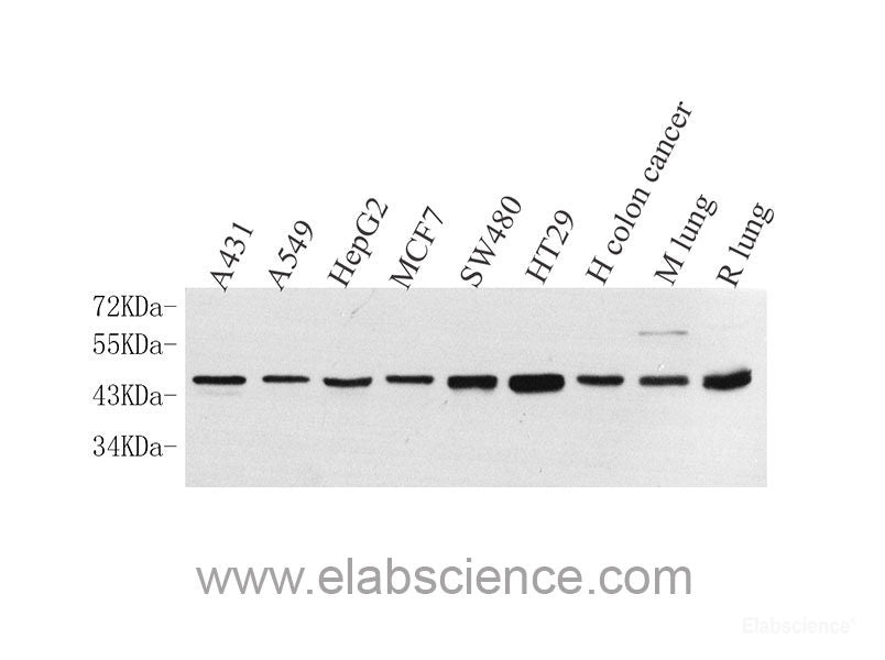 Immunohistochemistry analysis of paraffin-embedded mouse brain  using ACHE Polyclonal Antibody at dilution of 1:300.