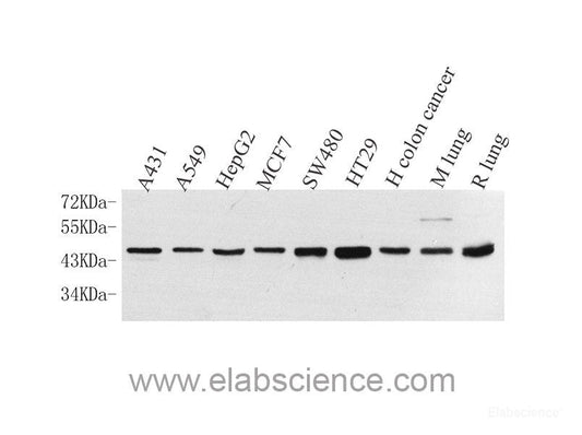 Immunohistochemistry analysis of paraffin-embedded mouse brain  using ACHE Polyclonal Antibody at dilution of 1:300.
