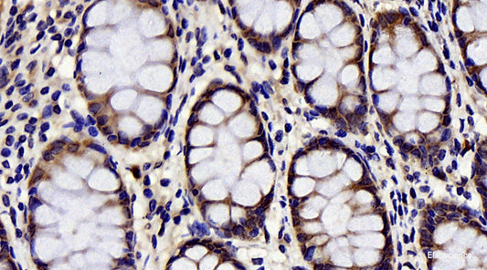 Immunohistochemistry analysis of paraffin-embedded human colon  using BAD Polyclonal Antibody at dilution of 1:300.