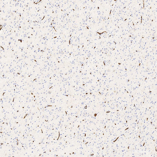 Western Blot analysis of various samples using DLG4 Polyclonal Antibody at dilution of 1:750.