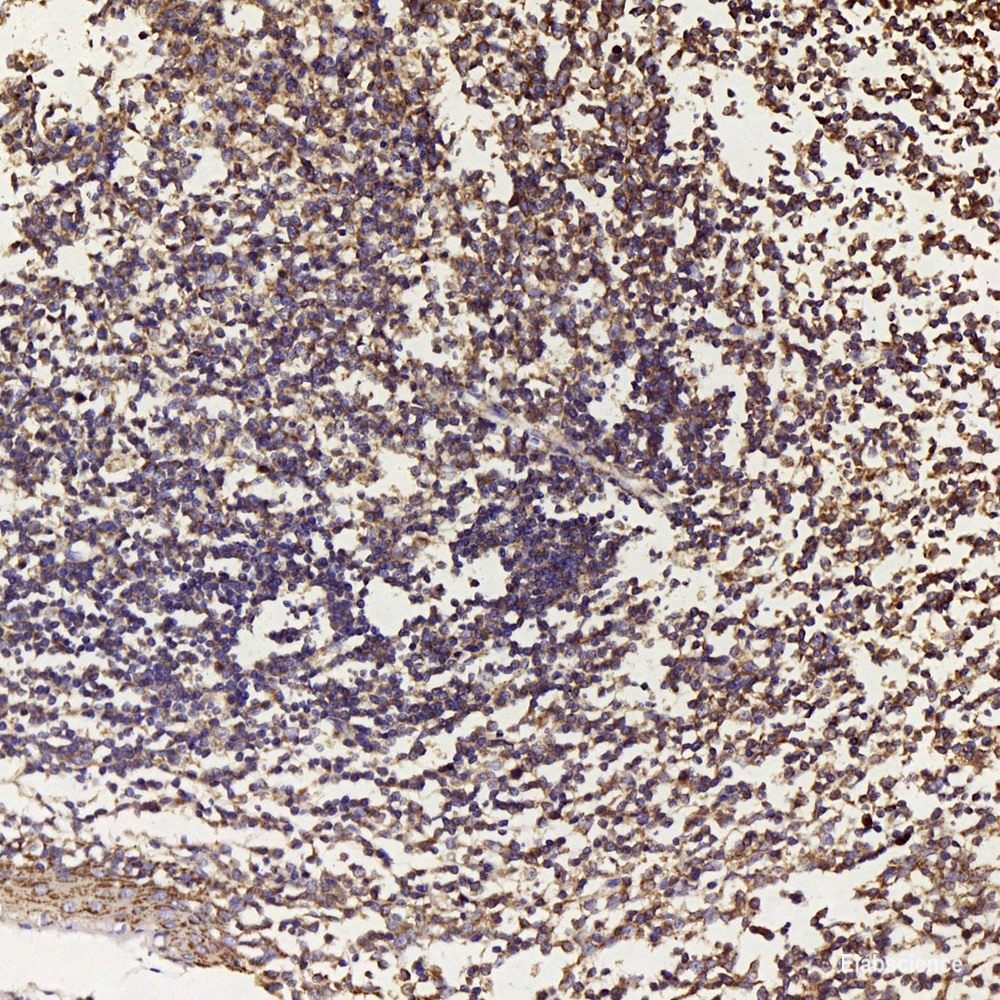 Immunohistochemistry analysis of paraffin-embedded rat heart  using HES2 Polyclonal Antibody at dilution of 1:200.