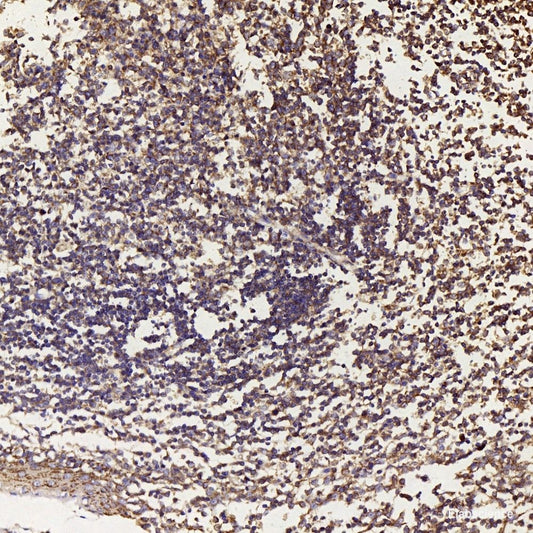 Immunohistochemistry analysis of paraffin-embedded rat heart  using HES2 Polyclonal Antibody at dilution of 1:200.
