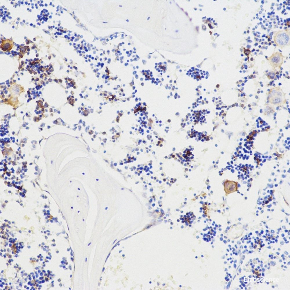 Immunohistochemistry analysis of paraffin-embedded human tonsil  using ERK 2 Polyclonal Antibody at dilution of 1:100.