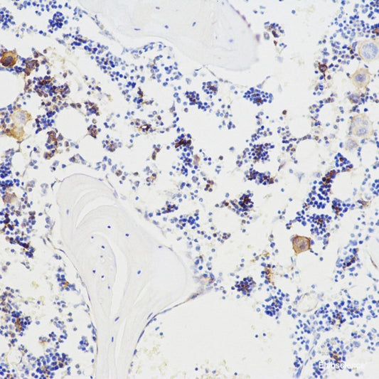 Immunohistochemistry analysis of paraffin-embedded human tonsil  using ERK 2 Polyclonal Antibody at dilution of 1:100.