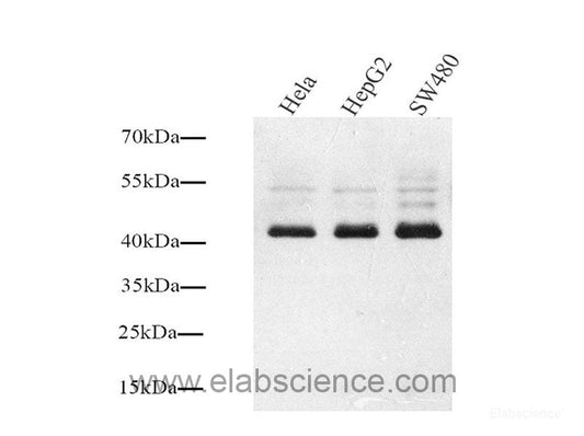 Western Blot analysis of various samples using MAP2 Polyclonal Antibody at dilution of 1:1000.