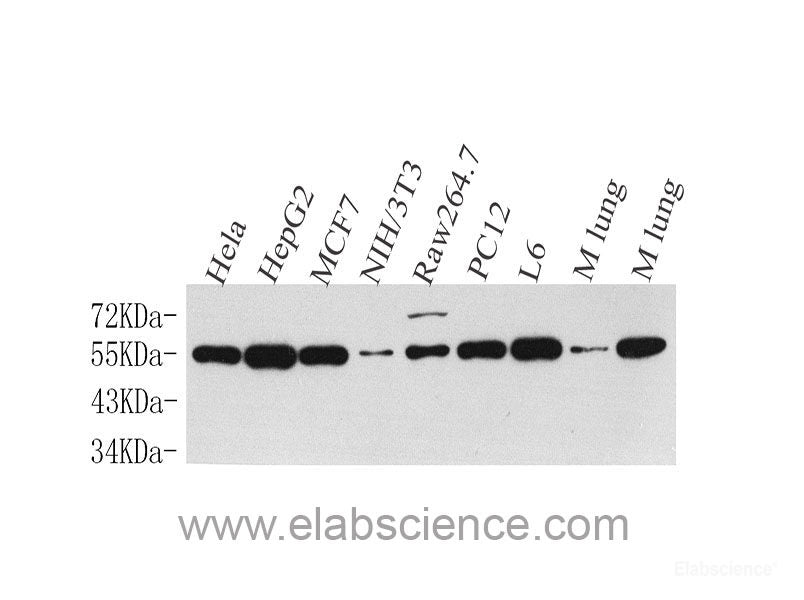 Immunohistochemistry analysis of paraffin-embedded mouse skeletal muscle  using DLL4 Polyclonal Antibody at dilution of 1:200.