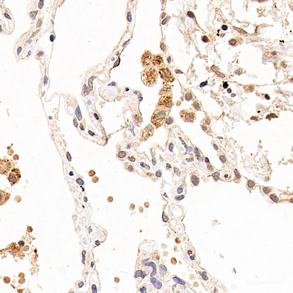 Immunohistochemistry analysis of paraffin-embedded mouse skin  using MGMT Polyclonal Antibody at dilution of 1:300.