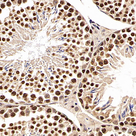 Immunohistochemistry analysis of paraffin-embedded human colon  using MAP2K1 Polyclonal Antibody at dilution of 1:100.