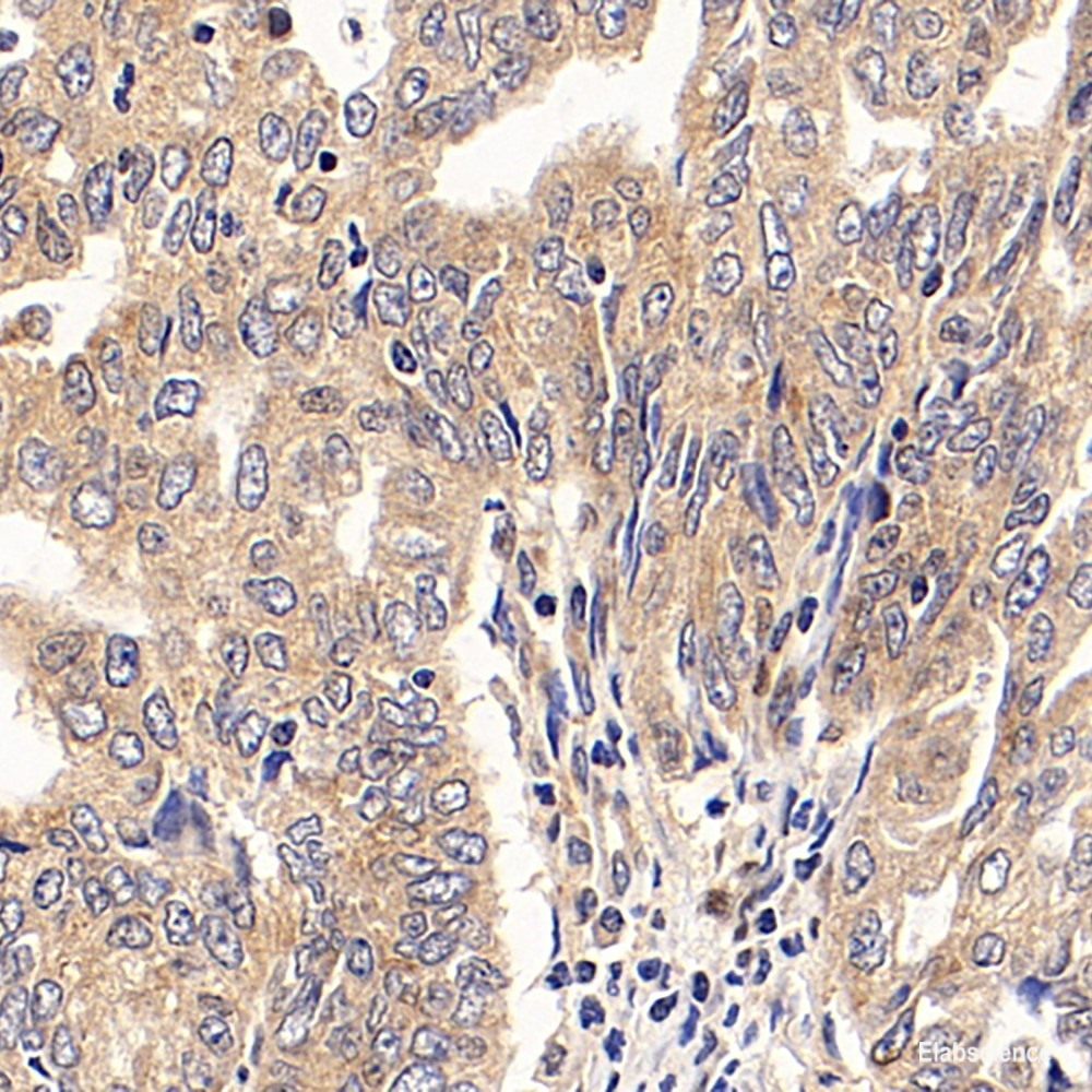 Immunohistochemistry analysis of paraffin-embedded human colon  using LEP Polyclonal Antibody at dilution of 1:100.