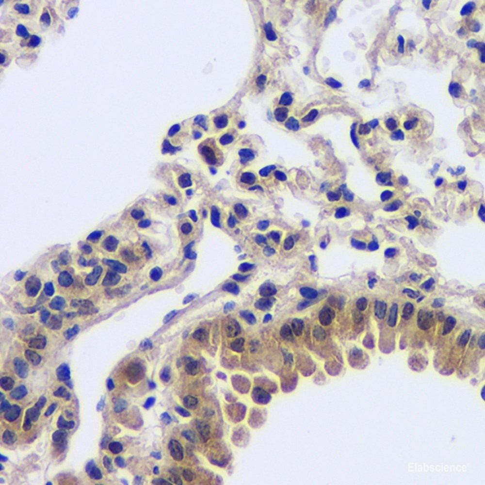 mmunohistochemistry analysis of paraffin-embedded mouse bone  using MMP13 Polyclonal Antibody at dilution of 1:200.