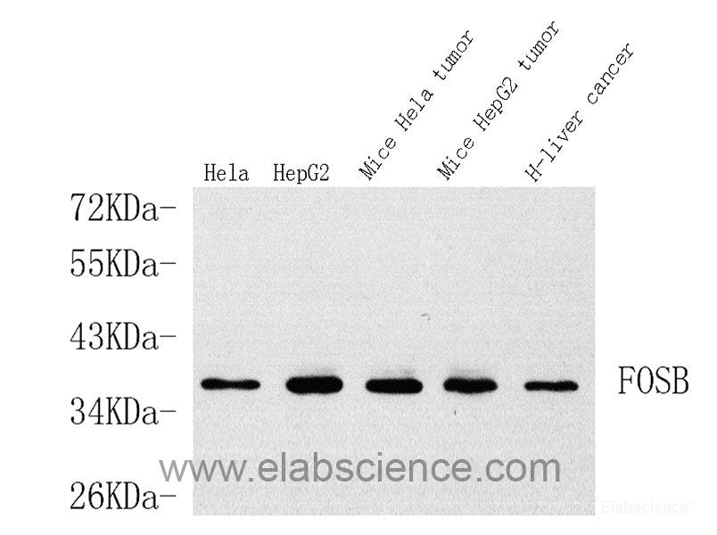 Immunohistochemistry analysis of paraffin-embedded Rat testis  using ACE1 Polyclonal Antibody at dilution of 1:300.