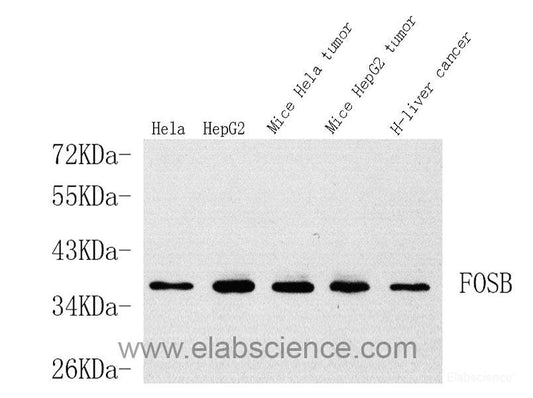 Immunohistochemistry analysis of paraffin-embedded Rat testis  using ACE1 Polyclonal Antibody at dilution of 1:300.
