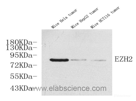 Immunohistochemistry analysis of paraffin-embedded mouse inflammatory lung  using MMP9 Monoclonal Antibody at dilution of 1:400.