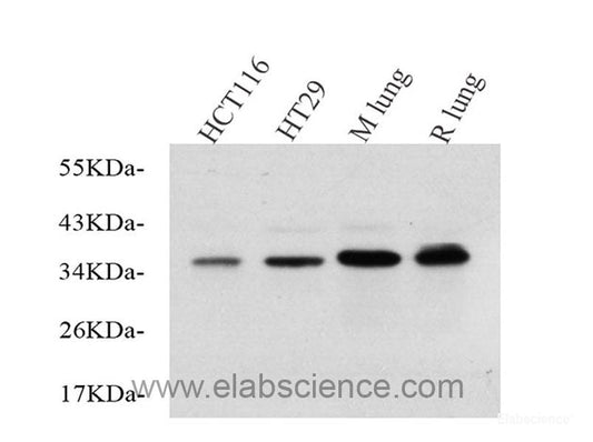 Western Blot analysis of various samples using CK-7 Monoclonal Antibody at dilution of 1:1000.